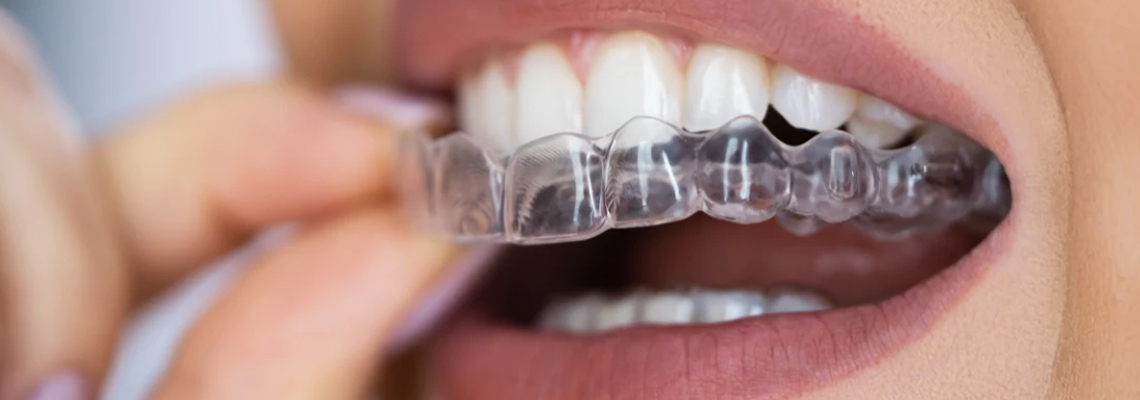 Invisalign & Beyond: Transforming Smiles with Orthodontics